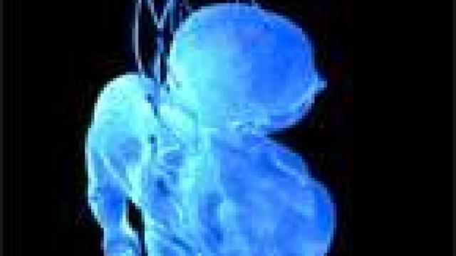 Image: Marina Nuñez, espectáculo barroco