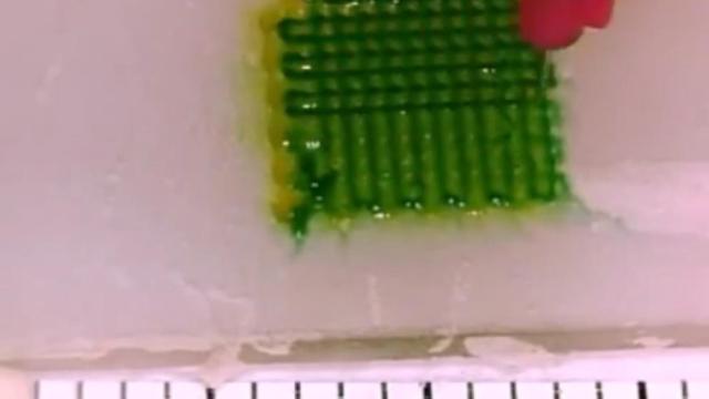 tumor_3d
