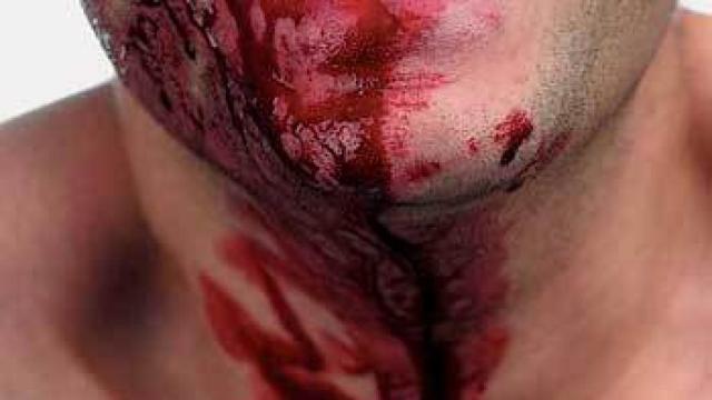 Image: Reiterativo Santiago Ydáñez