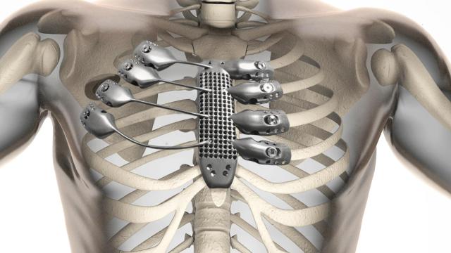 human radiography scan  with bones