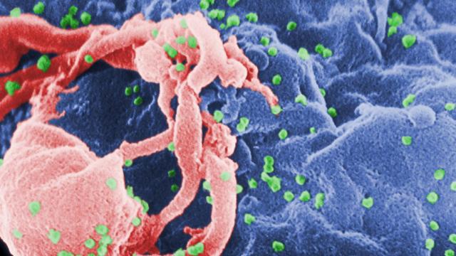 vih virus