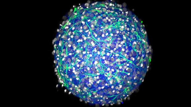 La esfera en 3D persigue superar los modelos bidimensionales.