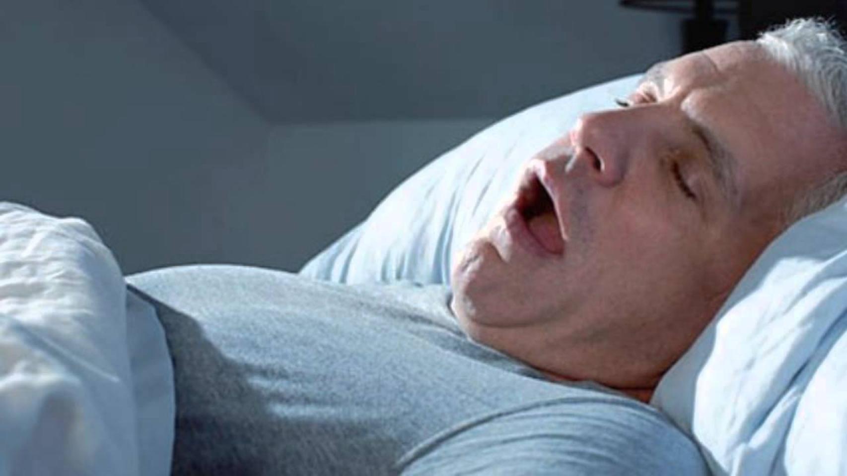 Apnea del sueño
