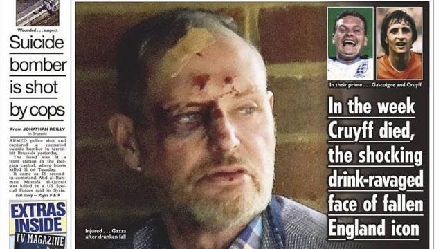 Paul Gascoigne deambula borracho y ensangrentado por la calle