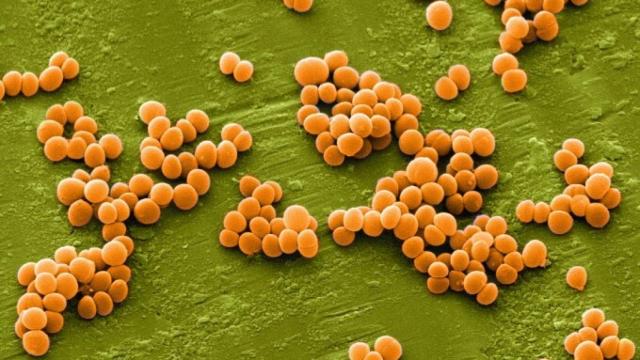 Staphylococcus-aureus-680x476
