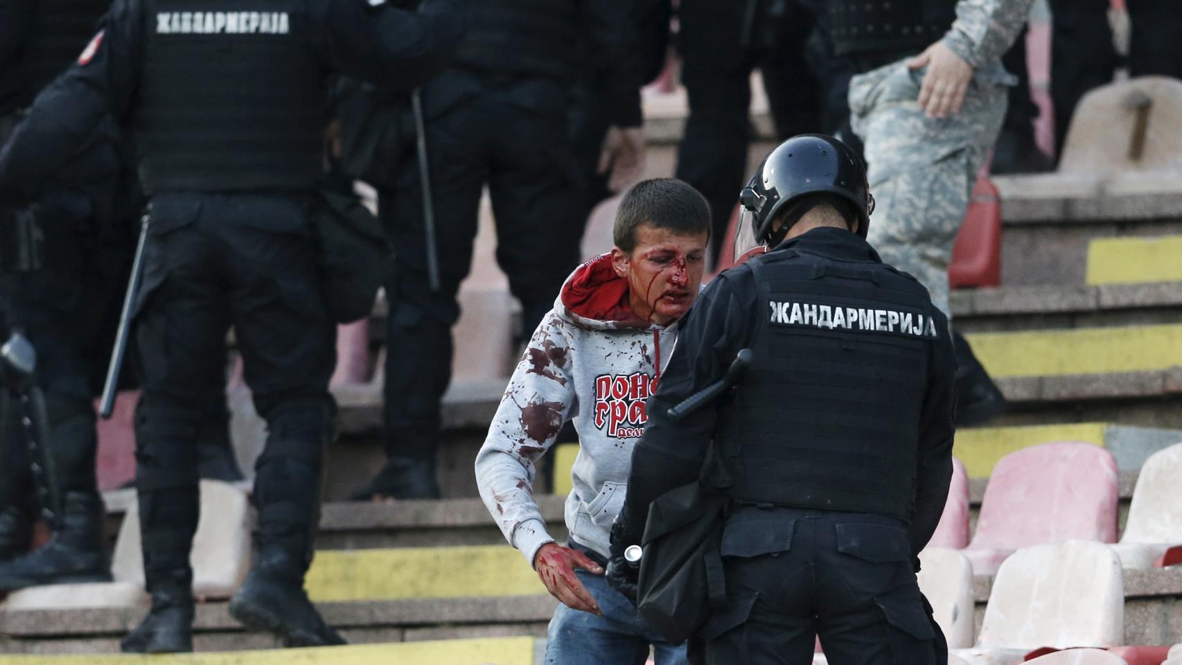 Un aficionado ensangrentado en el estadio.