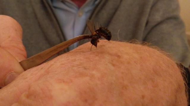 Las picaduras de abeja se utilizan en tratamientos para aliviar el dolor