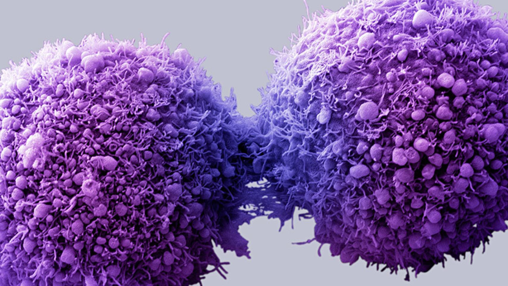 Metástasis de células cancerígenas.