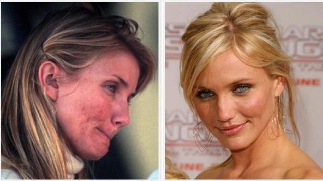 Cameron Diaz contó su lucha contra el acné en un libro.