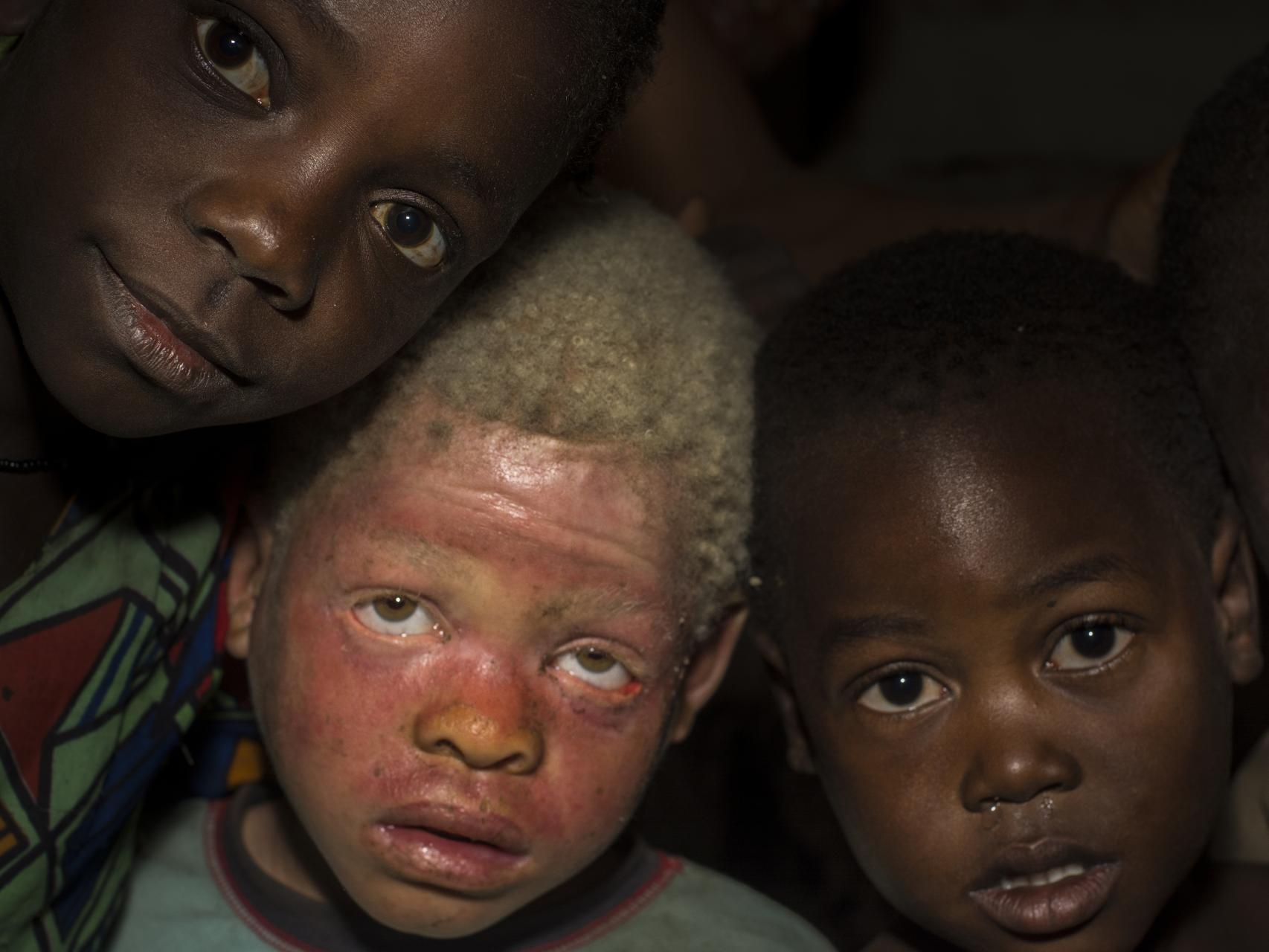 La creencia popular ve propiedades mágicas en sus huesos o creen que contienen oro.