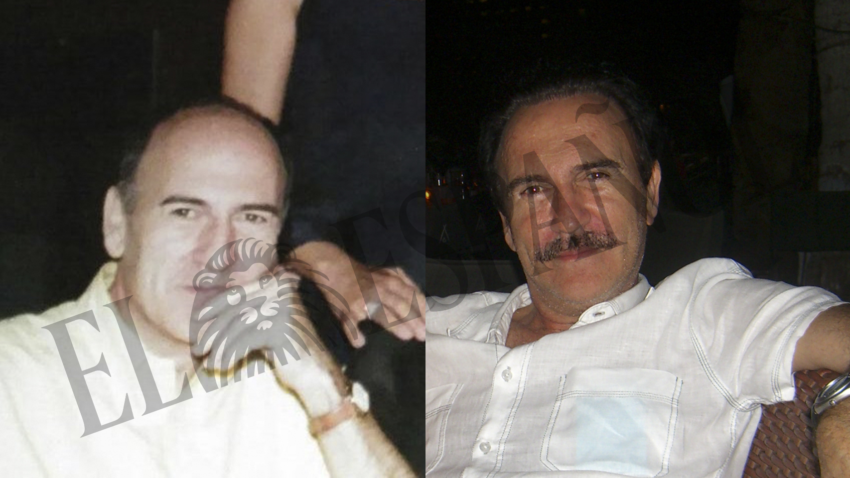 El antes y el después de las operaciones estéticas de Llorca.