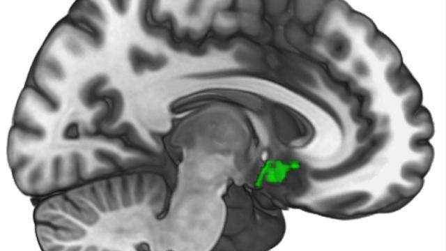 Esa pequeña región en verde es la que se ilumina cuando ayudamos a otros.