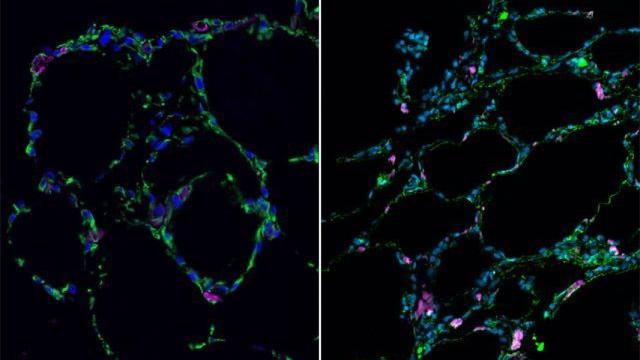 Desarrollan pequeños pulmones en probetas.