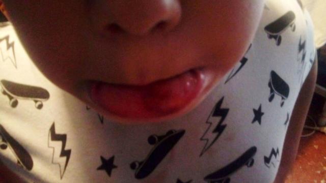 Foto cedida por la madre donde se aprecia daño en el labio y restos de sangre en la camiseta.