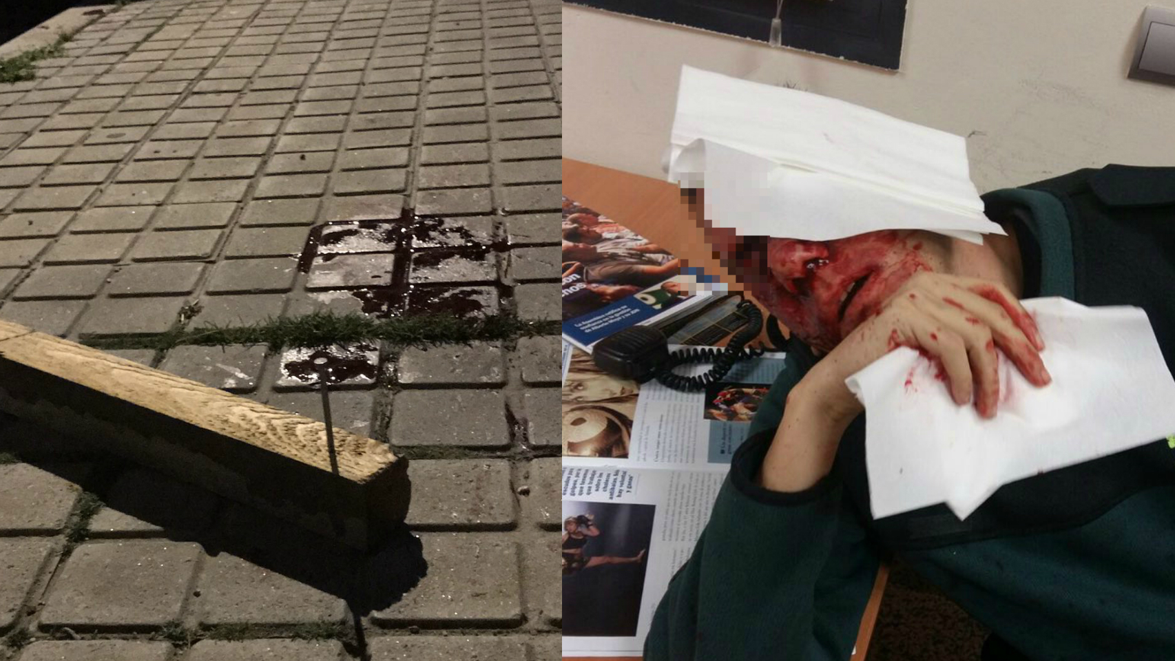 Imagen del arma utilizada y del agente agredido.