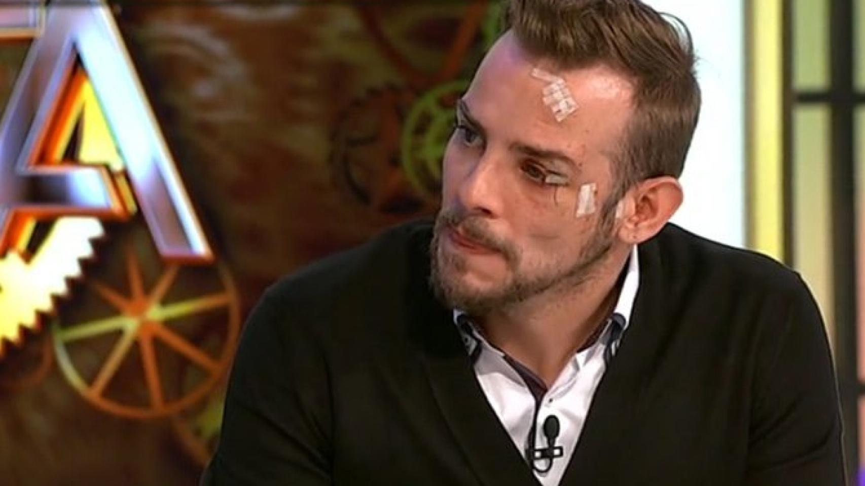 Àlex Casademunt, harto de la prensa, cuenta su verdad de su accidente en 'Hora punta'