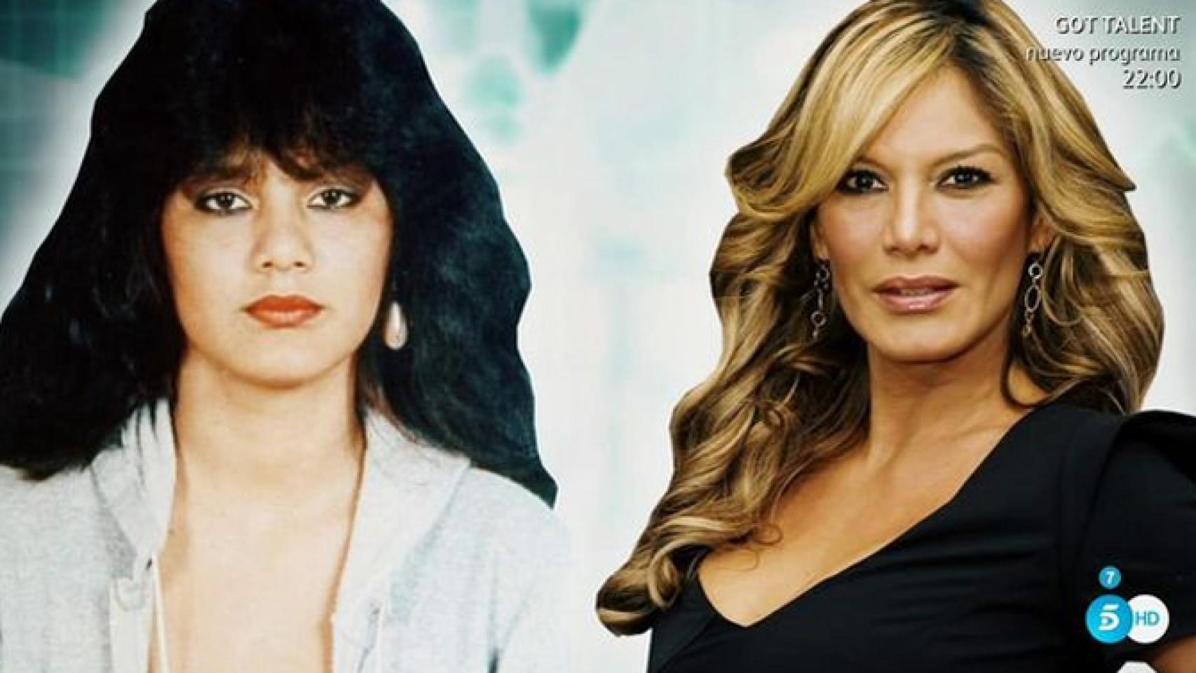 'Sálvame' destapa las numerosas operaciones estéticas de Ivonne Reyes