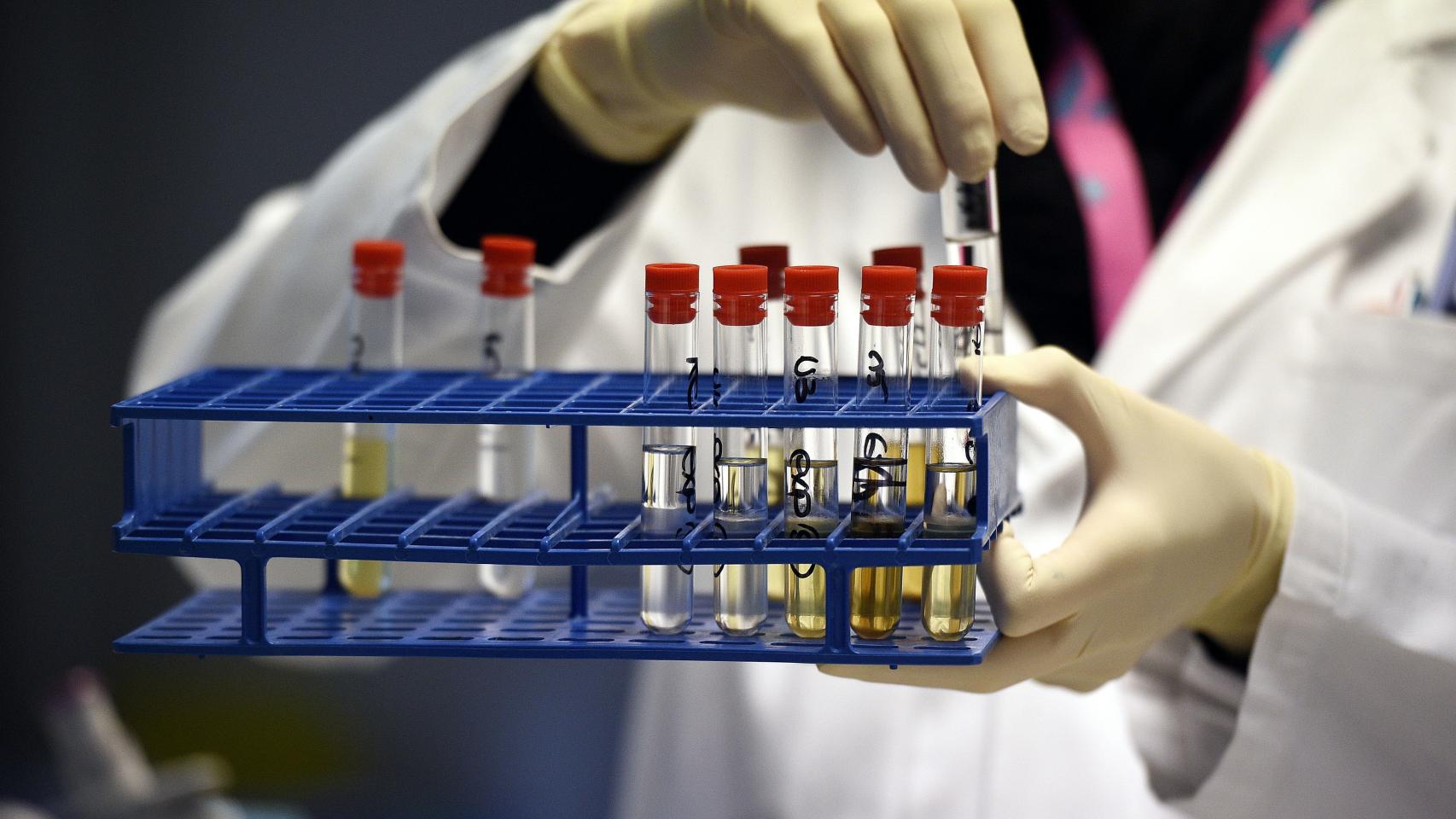 Muestras en un laboratorio antidopaje.