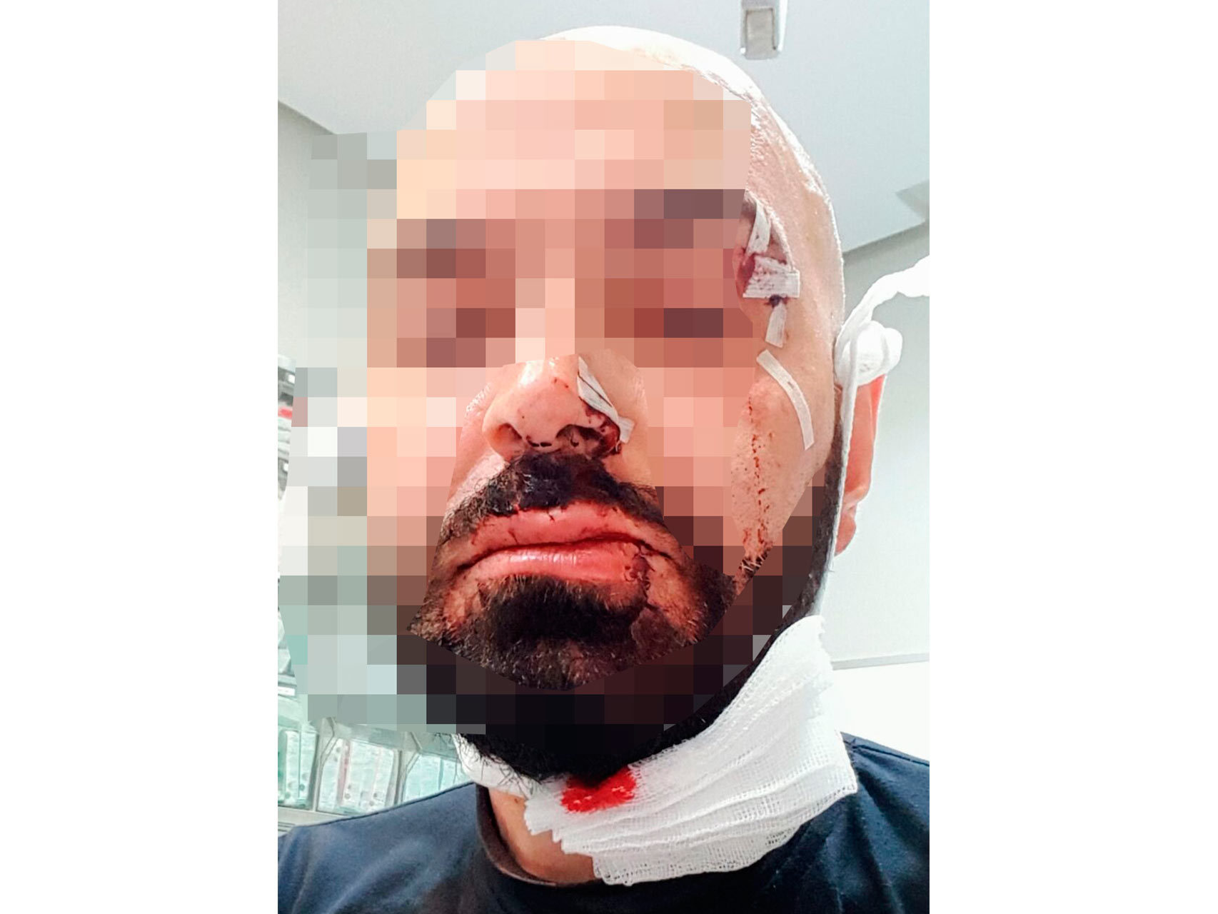 Un hombre sufre una agresión homófoba al salir de un pub de ambiente del centro de Madrid