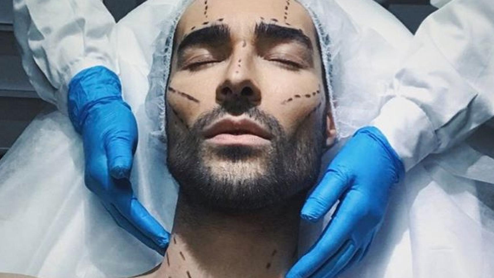 El cambio radical de Miguel ('GH 17') tras pasar por el quirófano