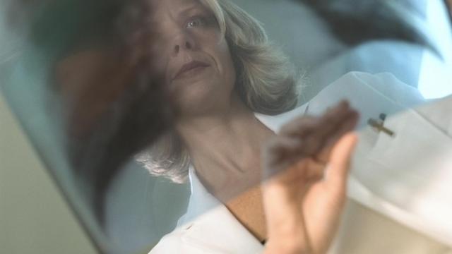 Una médica revisa una radiografía de pulmón