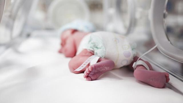 Un bebé prematuro en una incubadora.