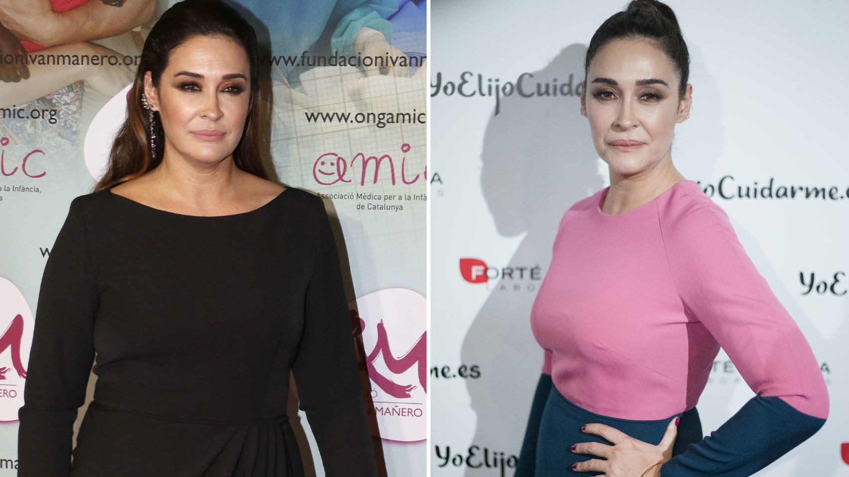 El antes y el después de Vicky Martín Berrocal.