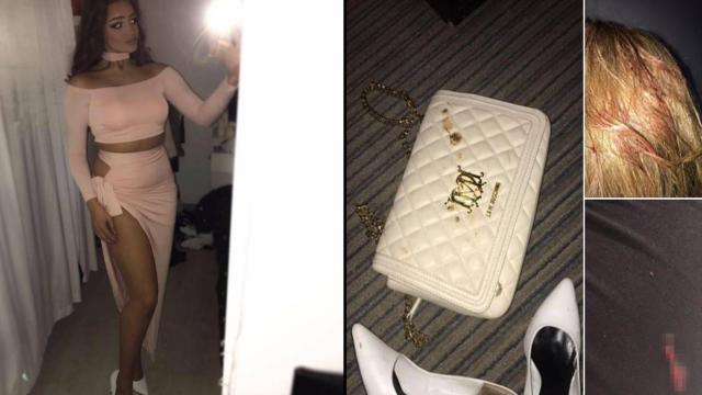 Abby Mullen en su perfil de Facebook con las fotos subidas tras el atentado.