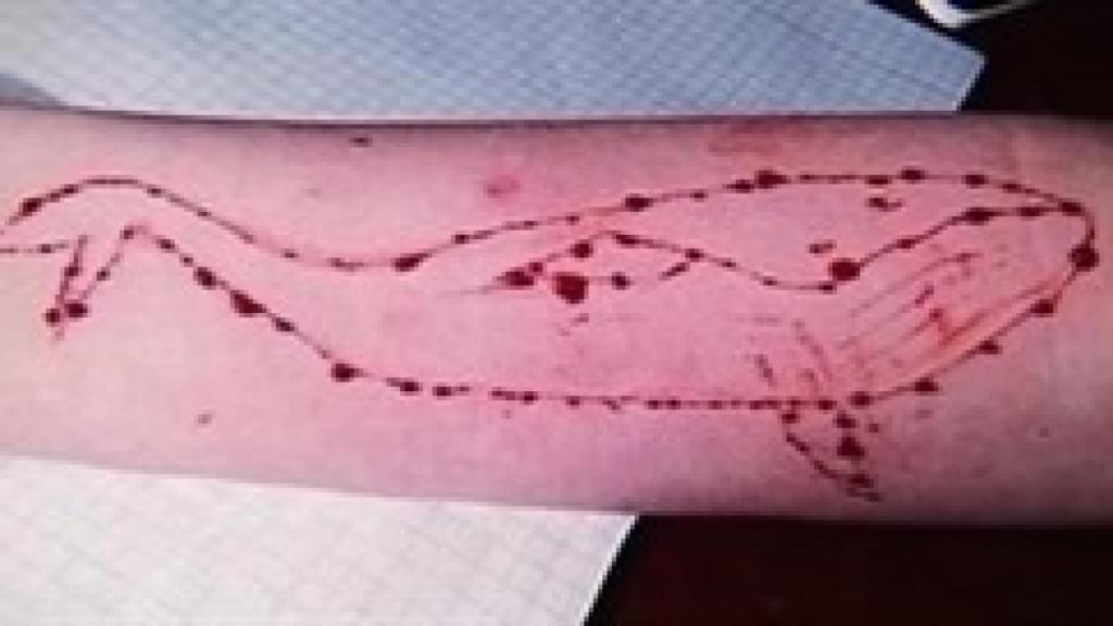 En este juego los jugadores muestran heridas  con la forma de este cetáceo.