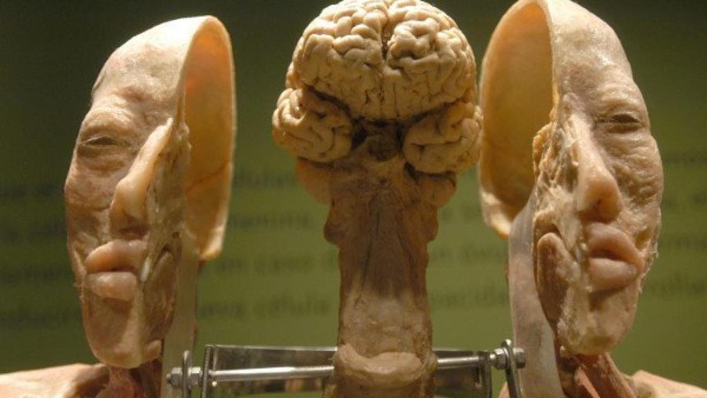 Imagen de un cerebro modelo