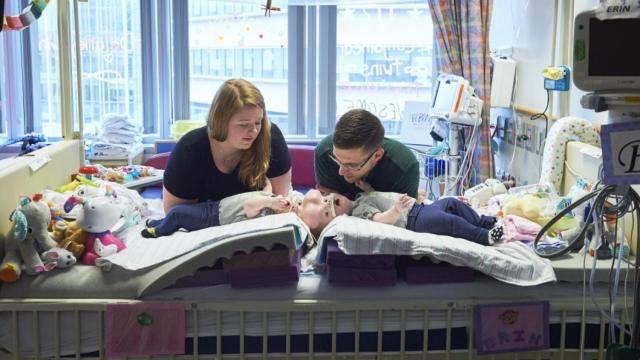 Los padres de las siamesas antes de la cirugía