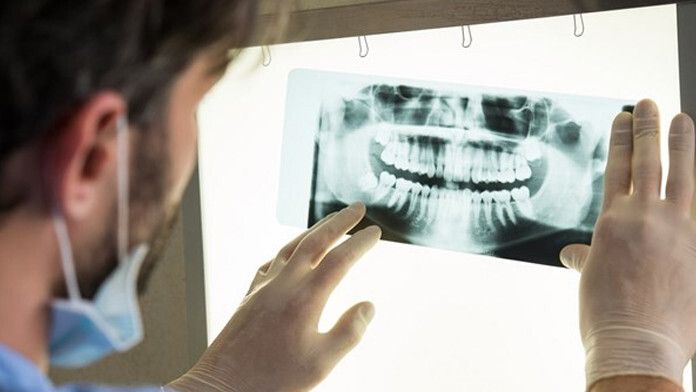 trending-topic-muelas-juicio-dentistas.