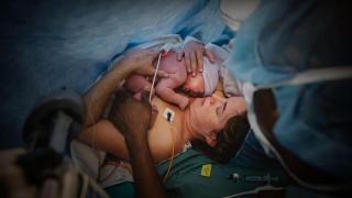 Aproximadamente, el 20% de los partos se llevan a cabo a través de una cesárea. Foto cedida por ELLIANA GILBERT