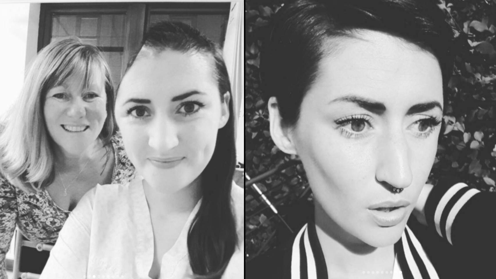 A la izquierda, Francesca Burr durante rehabilitación. A la derecha, actualmente.