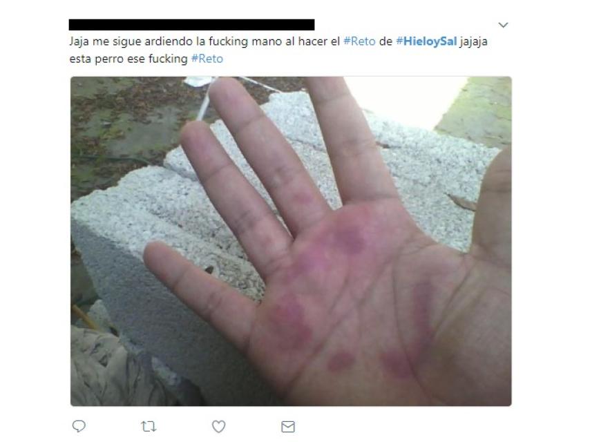 Heridas en la mano provocadas por el reto del que advierte la Guardia Civil.