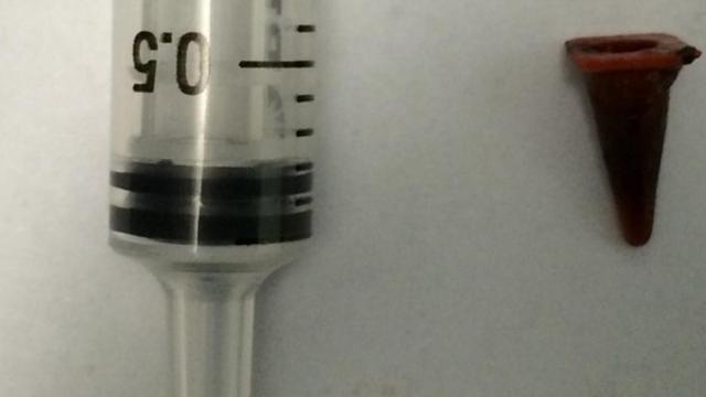 A la derecha, el minúsculo cono de Playmobil que se tragó el paciente.