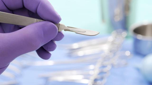 Atrapadas en la aduana por no parecerse al pasaporte tras una cirugía estética