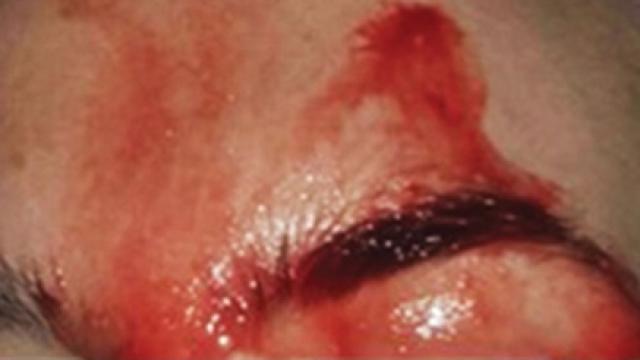 Imagen del rostro de la paciente.