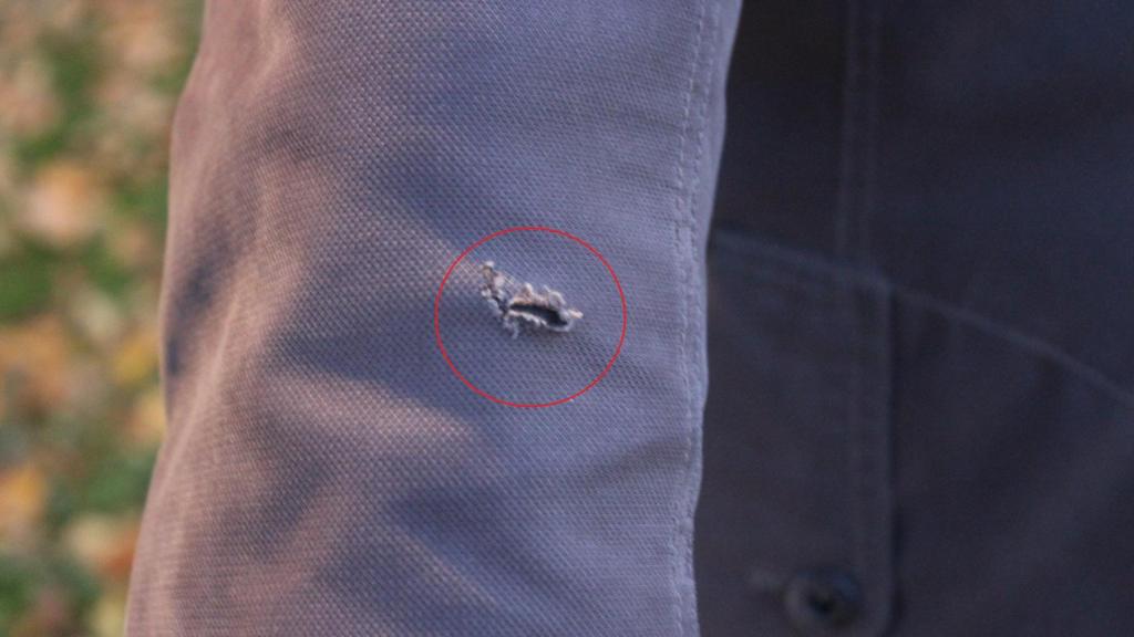 El perdigón le atravesó el abrigo, la sudadera y una camiseta.