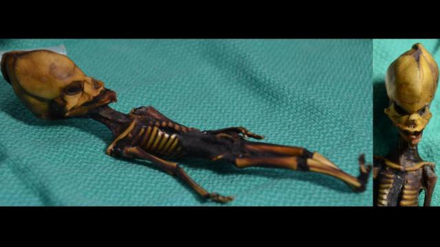 El esqueleto de Atacama, 'Ata'.