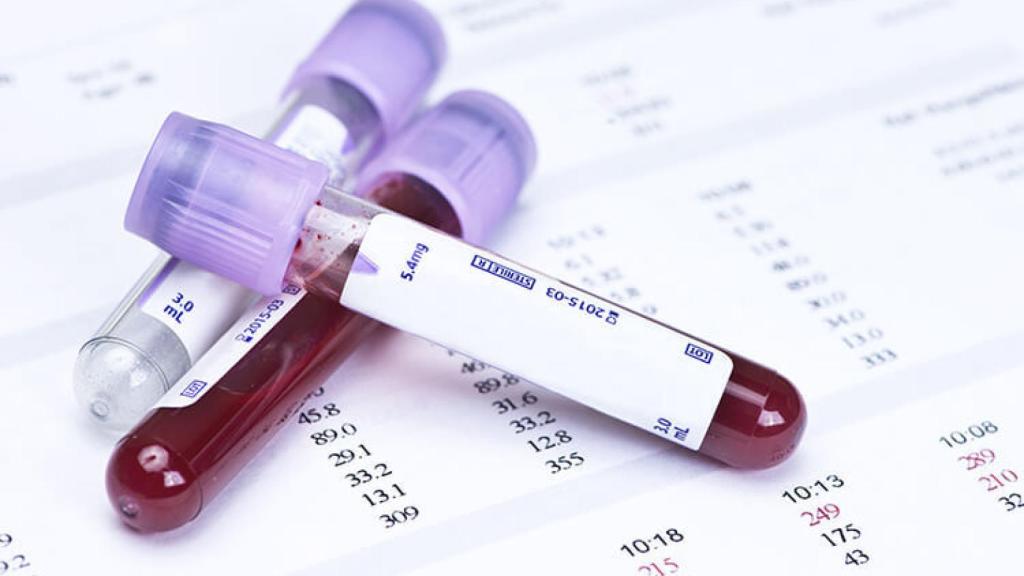 Unas muestra de sangre preparadas para su análisis.