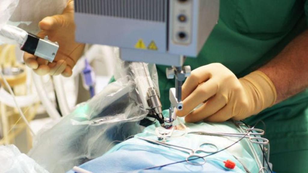 Un robot realizando una operación ocular.