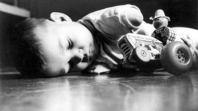 Un niño afectado por la talidomida.