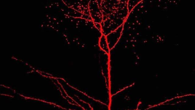 Las ramificaciones de las dentritas neuronales recuerdan a las de una rosa