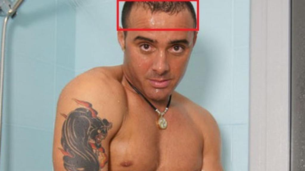 Imagen en el que se aprecia la calvicie de Dinio.