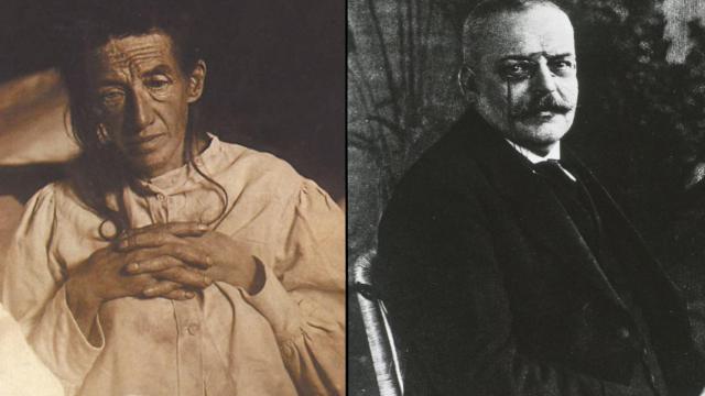 Auguste Deter (izqda) y Alois Alzheimer (drcha)