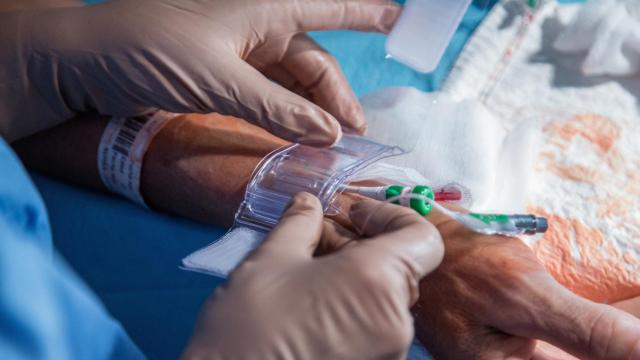 El catéter va desde la muñeca hasta el corazón. Foto Fernando Ruso