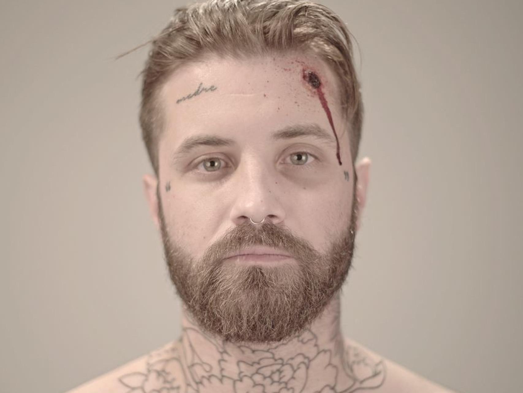 El artista Abel Azcona.