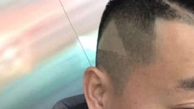 El extraño triángulo en la cabeza del hombre