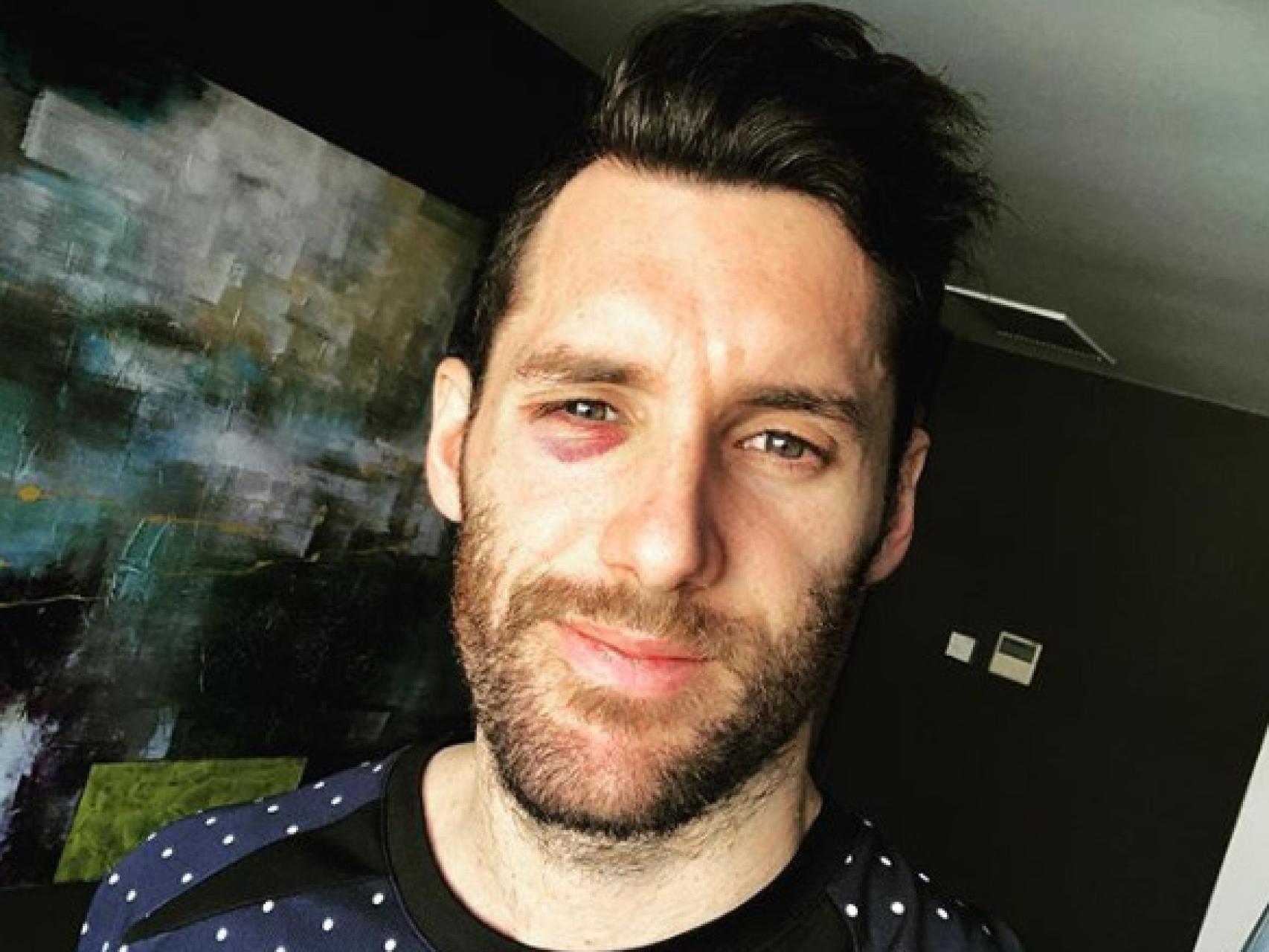 Rudy Fernández tras su golpe ante el Baskonia. Foto: Instagram (@rudy5fernandez)